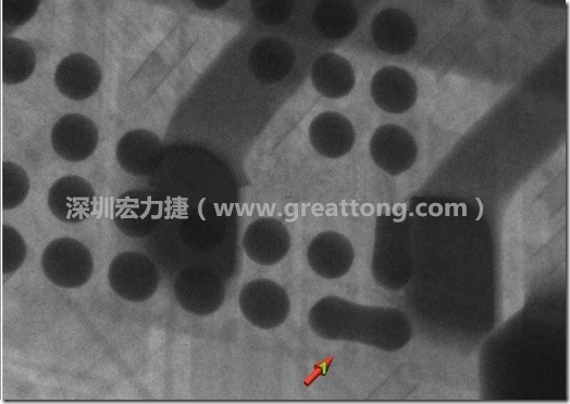 BGA因?yàn)楹笁|變小，造成錫膏過多而最終形成焊接短路的結(jié)果。